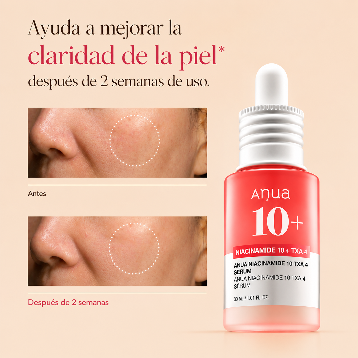 Sérum Anua Niacinamide 10% + TXA 4% Dark Spot Correcting Serum 30 ml – Ilumina y Unifica el Tono de la Piel